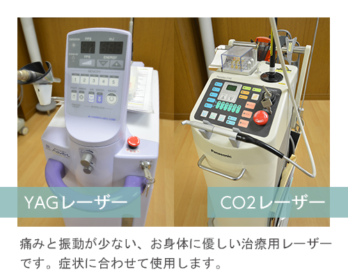 YAGレーザー